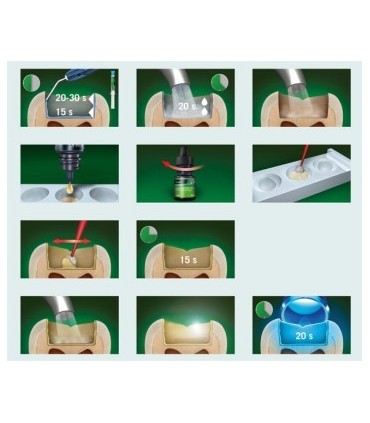 باندینگ|باندینگ نسل پنجم کولزر kulzer Gluma 2 bond