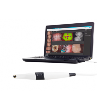 دوربین و رادیوگرافی دیجیتال|دوربین داخل دهانی Durr Dental-VistaCam iX HD