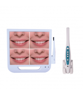 ست دوربین داخل دهانی و مانیتور - Toye