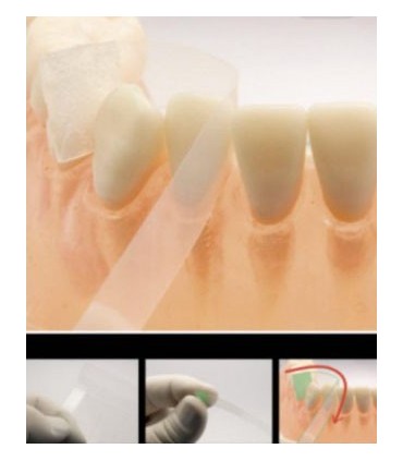 نوار سلولوئیدی تکسان