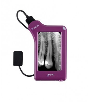 دوربین و رادیوگرافی دیجیتال|سنسور RVG مای ری My Ray سایز 1 مدل Xpod